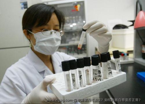 白带异常有何表现?如何判断白带是否正常?