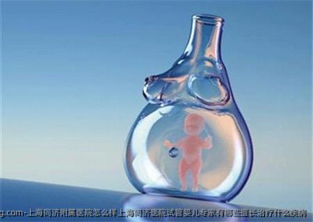 上海同济附属医院怎么样上海同济医院试管婴儿专家有哪些擅长治疗什么疾病
