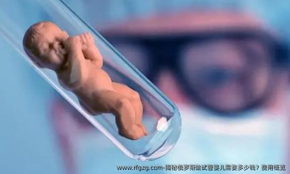 揭秘俄罗斯做代孕需要多少钱？费用概览