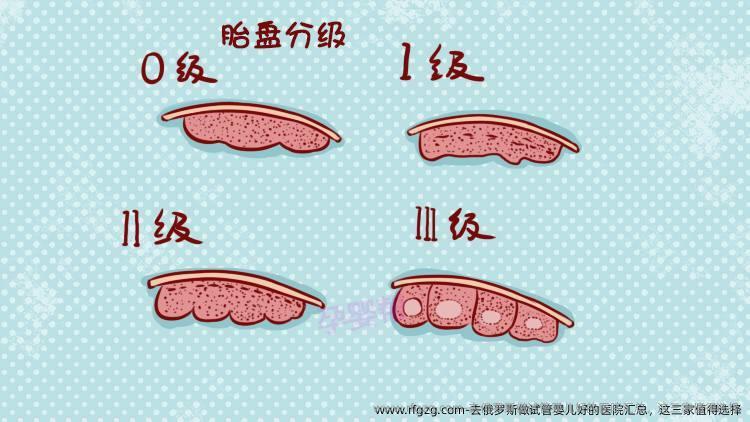 去俄罗斯做代孕好的医院汇总，这三家值得选择