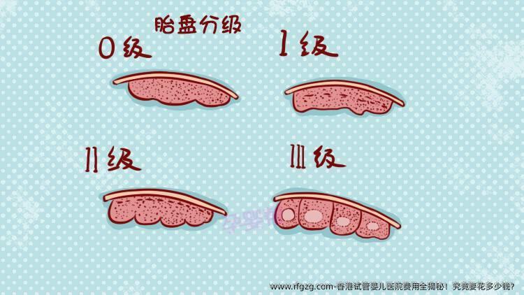香港代孕医院费用全揭秘!究竟要花多少钱?