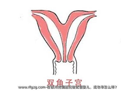 在银川附属医院做代孕,成功率怎么样?