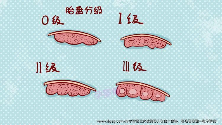 哈尔滨第三代代孕价格大揭秘，各项目明细一揽子解读！